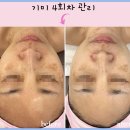 행복한피부 이미지