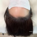 선헤어라인 이미지