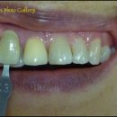 거창치과기공소 이미지