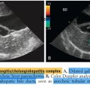 Ultrasonographic findings of feline cholangitis 이미지