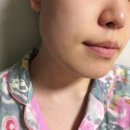 (주)레코시스템 | 올리브영 수부지세럼 화잘먹템 '믹순 히알레배 버블세럼' 올영세일템 추천