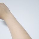 미소산약국 | 미소산 복용 1년 째 리얼 후기