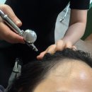 닥터모락 | 천호탈모 두피 관리 잘하는 닥터모락 천호점 방문후기