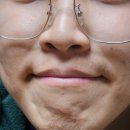 스노우의원 안산점 네이버블로그