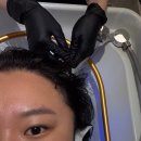 노원 두피관리 헤드스파 리메디 뷰티 두피 리프레시 관리 솔직후기