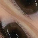 아임 메디칼 이미지