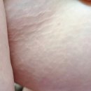 멜로스 | 헬로멜로스킨리부트 꾸준히 챙겨보는 중, PDRN 이너케어 시작한 후기