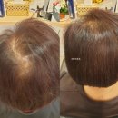 헤어체크 이미지