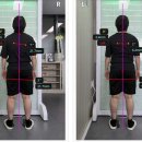 공릉PC | [공릉 체형교정] 목 어깨 통증 원인, 엑스바디 체형분석으로 찾은 거북목 &amp; 비대칭 교정 후기