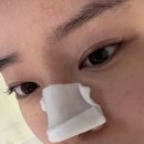 천안에스테틱 진피층 콜라겐부터 채워지는 동안관리 이정희스킨케어 후기
