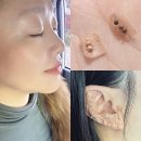 귀건강이혈테라피 | 귀지압으로 만성피로 개선 실화? 동탄귀이혈테라피 네일팅게일이 답인 이유