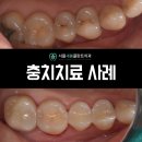 서울새봄플란트치과 이미지