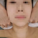 [직딩일기] 위례 윤곽관리 - 울쎄라 지속력 높이는 방법 / 유튜버 손민수하기/ 30대 얼굴관리