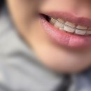 머리깎는아줌마 | 1월