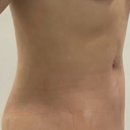 용진한의원 | 한달다이트 후기 “로하셀뺄타임”