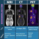 CT, MRI, PET-CT, SPET-CT 영상의학과 이미지