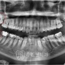 우리웰치과의원 이미지