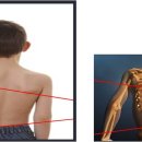 척추 수술/시술 판정 및 재발하신 분 전문[목 & 허리 디스크, 척추 협착증 & 측만증 & 분리증, 좌골신경통..] 척추/골반/재활 & 보디빌딩 1:1 맞춤 운동 전문 이미지