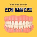 가까운치과기공소 | 부전역치과 좋은 임플란트의 3가지 과학적 기준