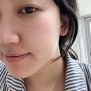 두송약국 | 더트포비아 이펙텀디솔루션 앰플 민감성 피부 앰플형 피지억제재 30대 여자 후기