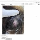 백민사 | 내가 겪은 공유 전동킥보드 사고 후기 (1) 사고진행과정