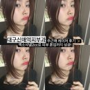 신매역 | 대구신매역피부과 주근깨 레이저 후기 ✨ 엑소샤넬2cc로 피부 톤업까지 성공!