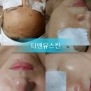 은 피부관리실