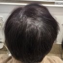 한올붙임머리 더 모어 정수리 커버 솔직 후기