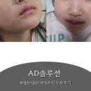 내돈내산/ 안 따가운 아토피크림 '에이디솔루션' 한달 사용 솔직 후기