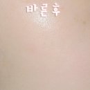 브이아이피테라피