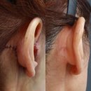 동우메디칼 | 압구정안면거상, 상담실에서 꼭 확인해야 할 질문 TOP5