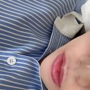연신내피부과 쥬브겔 입술필러 내돈내산 솔직 후기