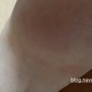 노운섭한의원 이미지