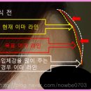 이마 이미지