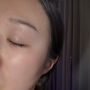 수화약국 | 강남역 고우리 스킨부스터 3일차, 통증, 효과 찐후기