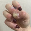 [공지] 30년 동행한 접촉성 피부염, 헤모힘으로 사라졌어요 – 감기·피부·피로 개선 체험 후기