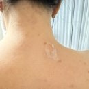아루아 에스테틱 | 동탄 등필링 잘하는 아루아에스테틱에서 약초필 받은 후기