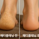 &#34;의정부 발각질 관리 1등, 에스뷰티샵 고객후기 공개&#34;