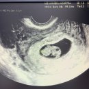 [ANNA의 신혼이야기] 2024 싸이 흠뻑쇼 스탠딩 SR석 - 임산부가 다녀왔던 후기 (대전 흠뻑쇼)