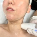 루밍에스떼 | 민락동피부관리 이중턱 리프팅 루밍에스떼 의정부점
