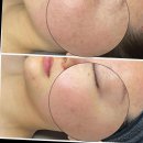 르몽에스테틱 | 전포피부관리인 르몽에스테틱 후기