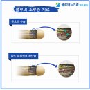 블루비뇨기과의원 이미지