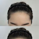 수헤어라인 이미지