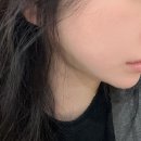 얼굴 붓기 때문에 시작한 디오스톡 붓기연화제 내돈내산 후기