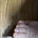 큐어메디 | 아빠 발톱 문제성 발톱 앰플 후기 메디살 셀라팜으로 발톱 무좀 걱정 줄였어요