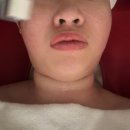 오목교역 4번출구 | 세레니끄 목동점에서 피부관리 받고 왔어요! MTS 관리까지 경험한 후기