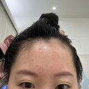 예뻐졌다전포점 | 서면두피관리 승모근관리엔 예뻐졌다 전포점 두피관리 후기
