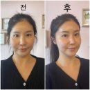 63세탁전문점 | 대구 수성구 범어동 윤곽관리 자연을 닮은 피부관리실 스톤 아로마 시그니처 전신 테라피 후기