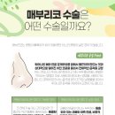 경우 이미지