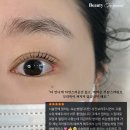 더모먼트 이미지